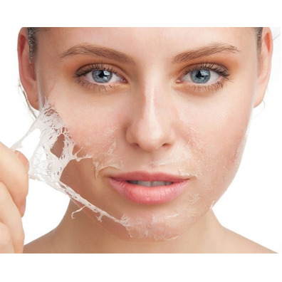 Tratamiento Facial - Peeling Médico