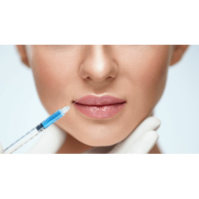 Tratamientos Medicina Estética - Relleno de Labios