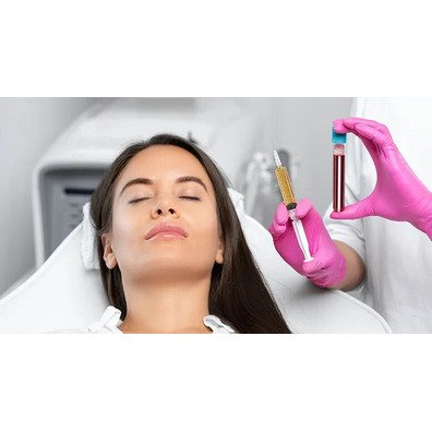 Tratamientos Medicina Estética - Plasma Rico en Plaquetas