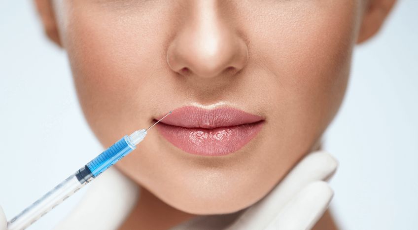 RELLENO DE LABIOS